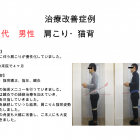【症例】福岡市中央区薬院在住　Ｗ様の歩行時の股関節の痛みが改善いたしました。