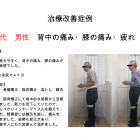 福岡市南区高宮在住　Ｗ様の猫背姿勢・肩こりが改善いたしました。