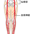 骨盤の歪みと坐骨神経痛の関係について